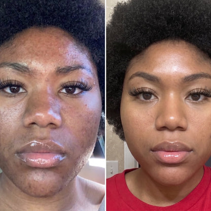 Glutathione Dark Spot Patches